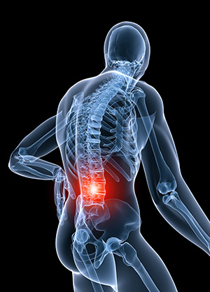 back pain hunter valley raymond terrace osteopathic treatment